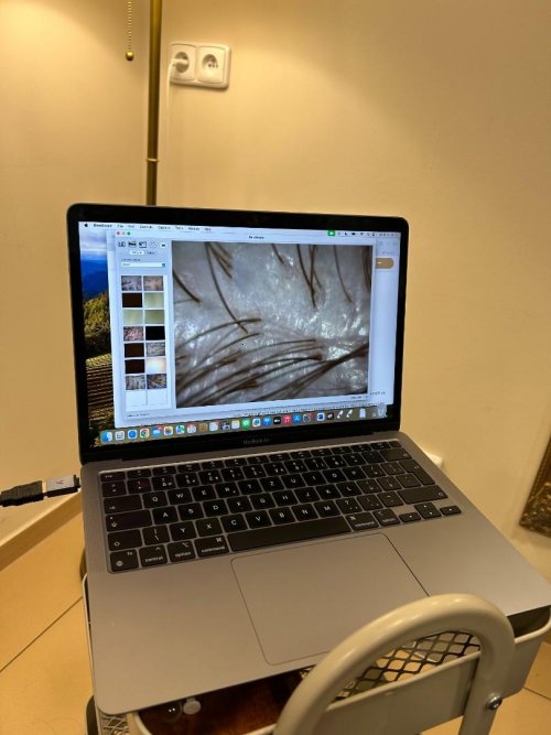 Odborná exkurze - Trichologie v praxi 3  