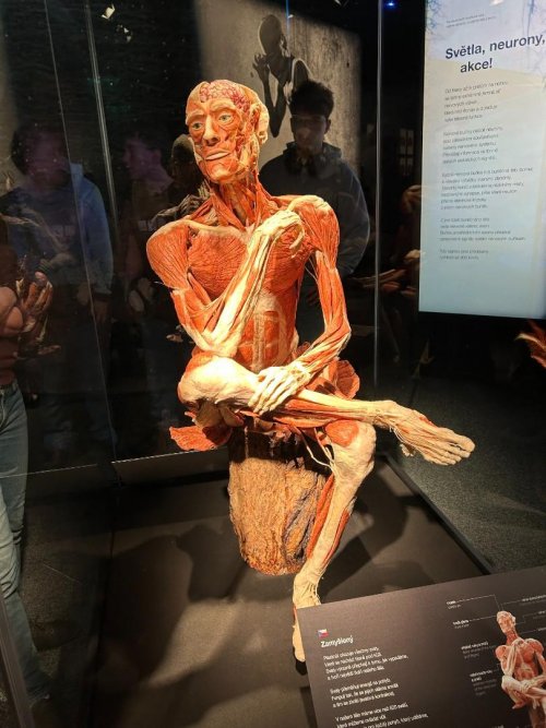 BODY WORLDS - výstava 6  