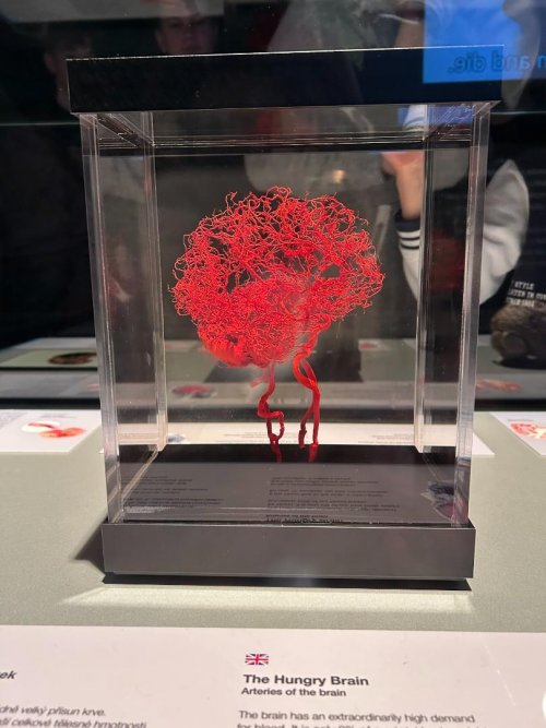 BODY WORLDS - výstava 2  